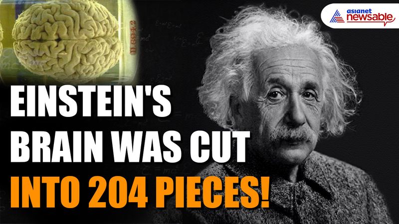 Did you know? Albert Einstein's brain was stolen, cut into 240 pieces! (WATCH)