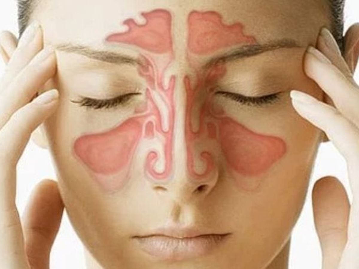 সাইনাস কী, জেনে নিন এই রোগের প্রাথমিক লক্ষণ ও প্রতিকার | know about  sinusitis and its causes and treatment