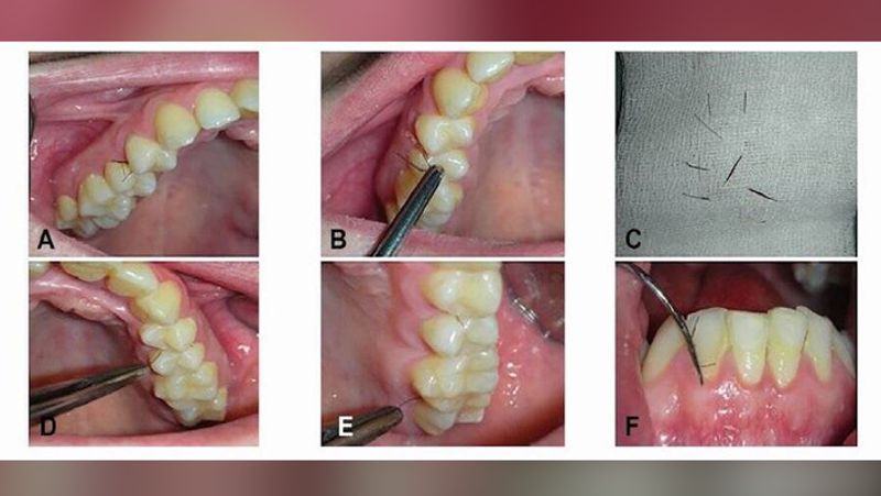 Recently a special report about the disease was published in the Oral Pathology General.