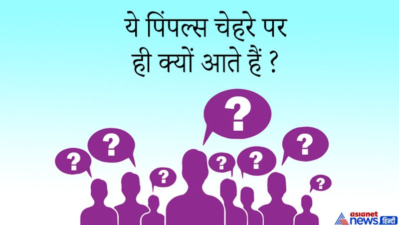 <p><strong>जवाब: </strong>यूपीएससी वाले कैंडिडेट को हर विषय की जानकारी होनी चाहिए<strong>&nbsp;</strong>इसलिए आम जिंदगी वाले सवाल पूछ लिए जाते हैं जिनका सीधा मतलब विज्ञान से होता है। इस सवाल का जवाब कैंडिडेट ने ऐसे दिया-&nbsp;&nbsp;आमतौर पर एंड्रोजन हार्मोन द्वारा पिंपल को ट्रिगर किया जाता है, इसके अलावा स्किन ओयली होने की वजह भी पिंपल होते हैं दूसरा ये समस्या जेनेटिक भी हो सकती है।&nbsp;</p> 
