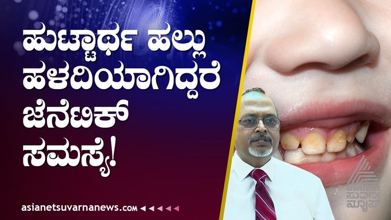 ಹುಟ್ಟುತ್ತಲೇ ಮಕ್ಕಳ ಹಲ್ಲು ಹಳದಿಯಿದ್ದರೆ ಜೆನೆಟಿಕ್ ಸಮಸ್ಯೆ!