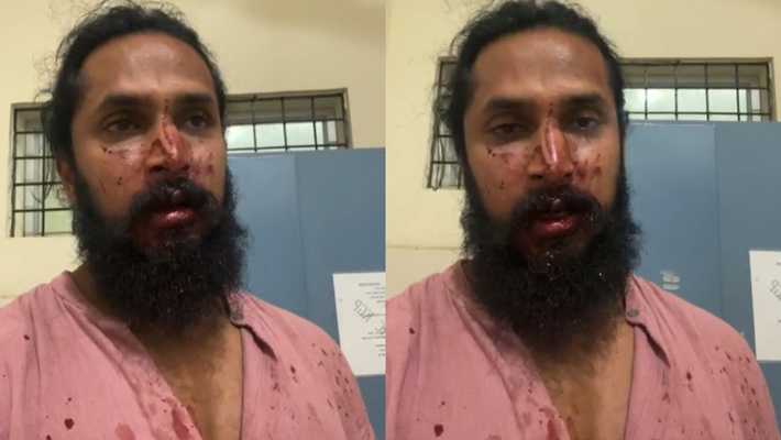 ನಟ ಚೇತನ್ ಚಂದ್ರ ಮೇಲೆ 20ಕ್ಕೂ ಹೆಚ್ಚು ಪುಂಡರಿಂದ ದಾಳಿ: ಓರ್ವ ಆರೋಪಿ ಬಂಧನ