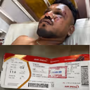 Ahmedabad plane crash: What saved Viswashkumar in seat 11A? Lone survivor recounts horror