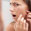Clear Your Skin Naturally: Best Home Remedies for Small Pimples on Face