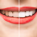 5 teeth-whitening hacks that you can do at home