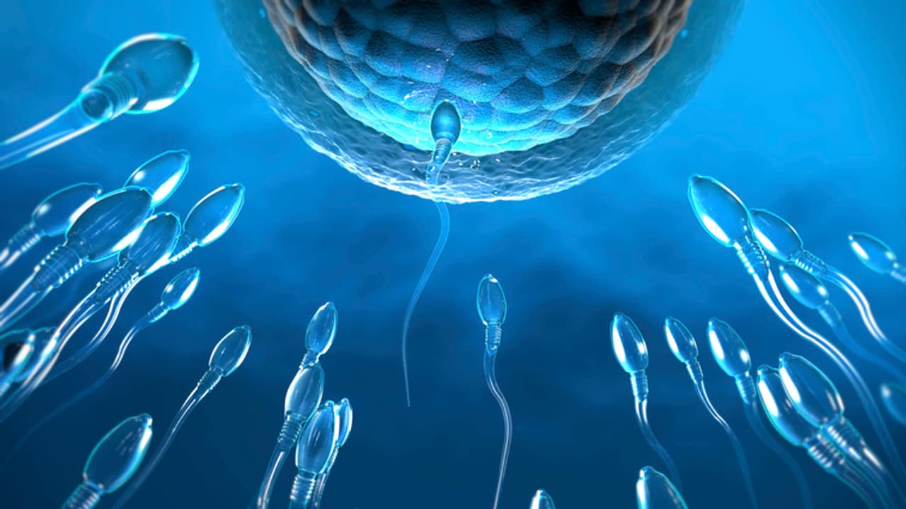 Male Infertility Male Infertility