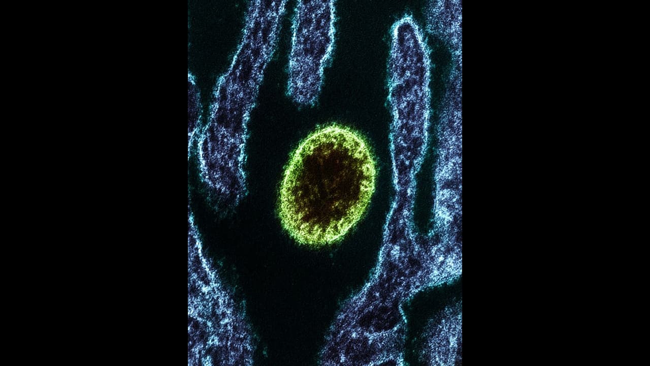 Nipah Virus Nipah Virus