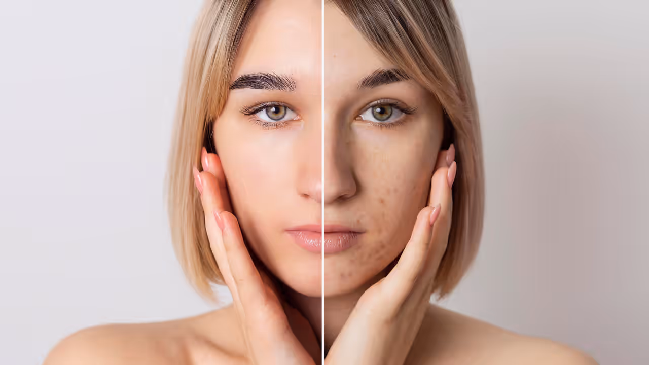 pigmentation problem remedies
