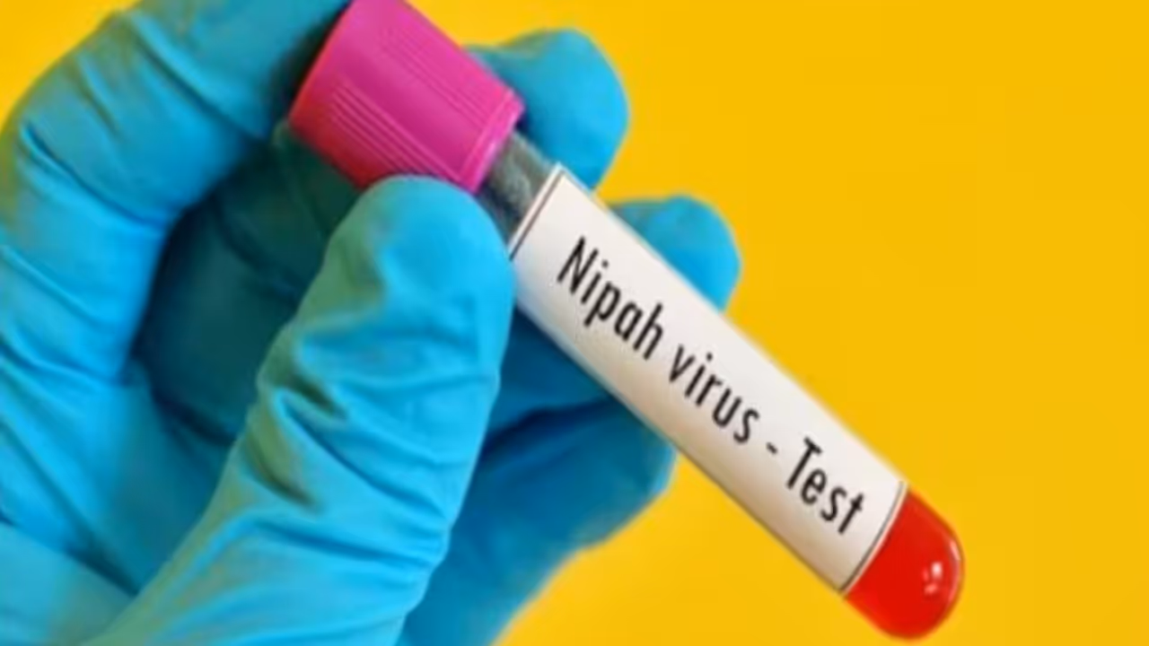 Nipah Virus Nipah Virus
