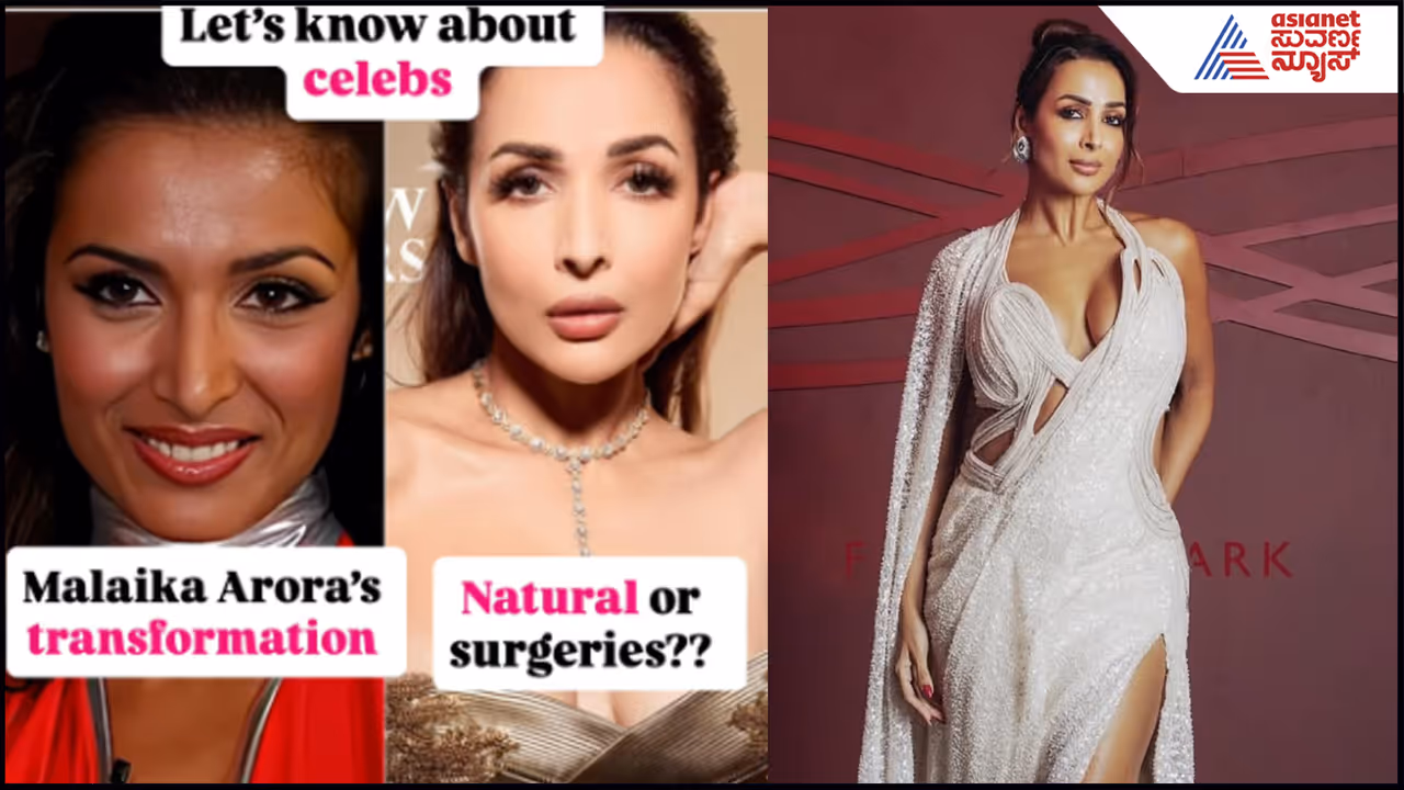 Malaika Aroras Surgery on all parts