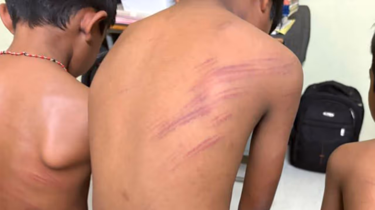 Guest teacher accused of beating three students in Shivamogga Guest teacher accused of beating three students in Shivamogga