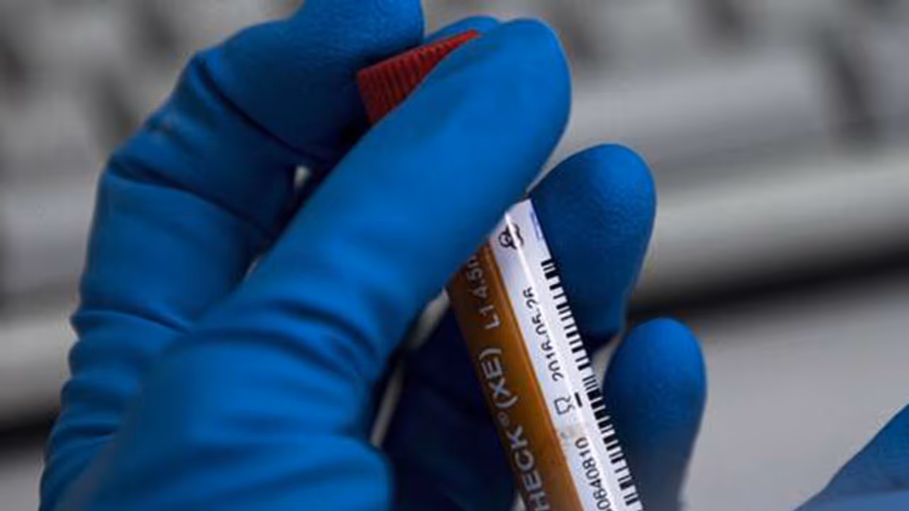 Doping Test Doping Test