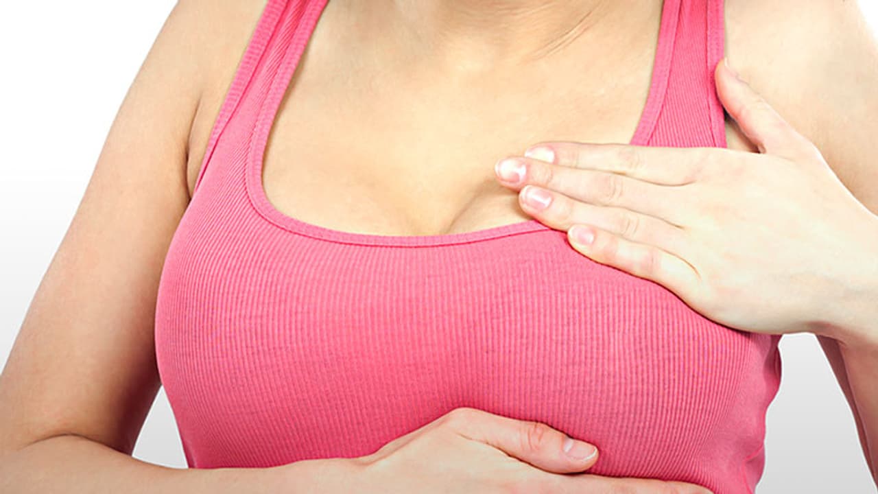 Breast Cancer1 Breast Cancer1