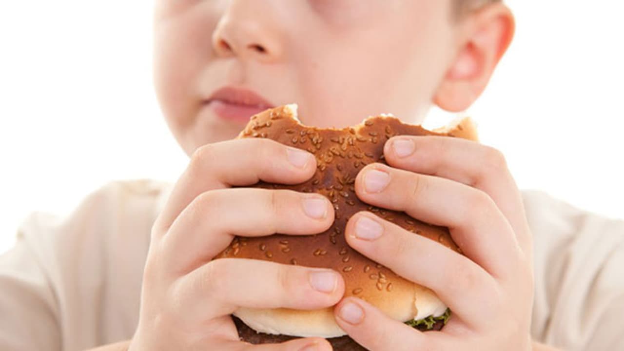 Obesity in children
