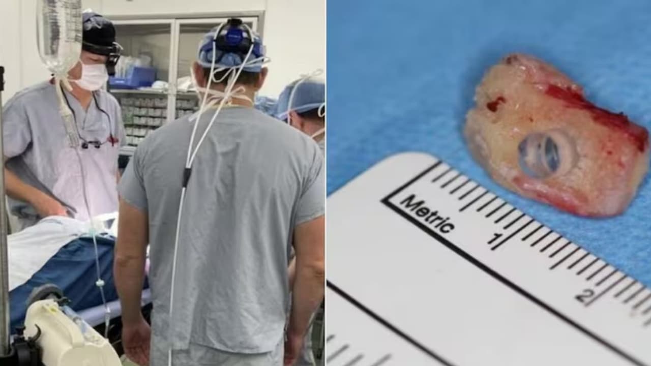 canadian women operation canadian women operation