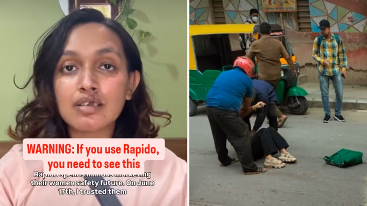 Bengaluru Taxi Horror: Woman Sues Rapido After Bike Crash Leaves Her With Rs 20 Lakh Hospital Bill Bengaluru Taxi Horror: Woman Sues Rapido After Bike Crash Leaves Her With Rs 20 Lakh Hospital Bill