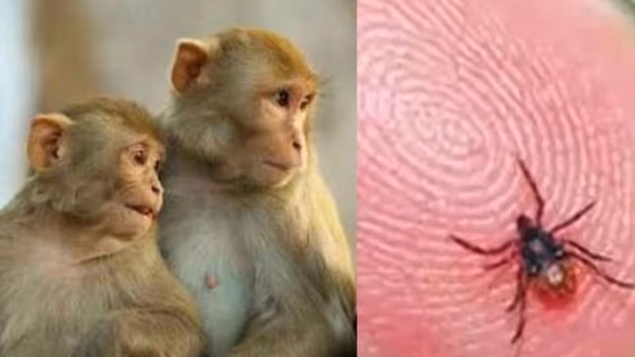 Early KFD case detected in Shivamogga as health teams intensify checks Early KFD case detected in Shivamogga as health teams intensify checks