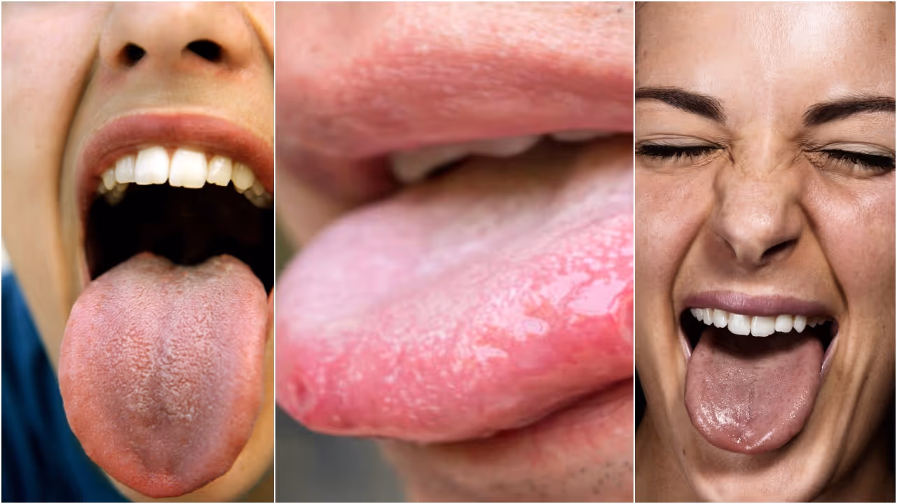 Tongue Color Tongue Color