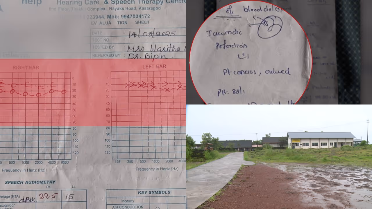 ear drum broken ear drum broken