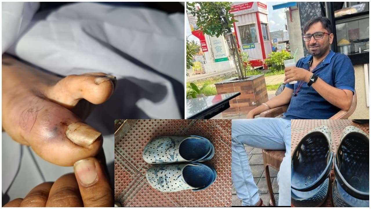 Bannerghatta man dies from snake bite