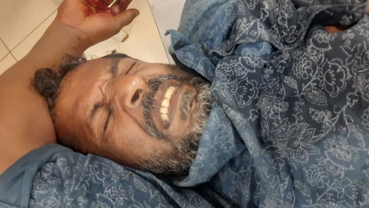 Man lost palm as thotta blast