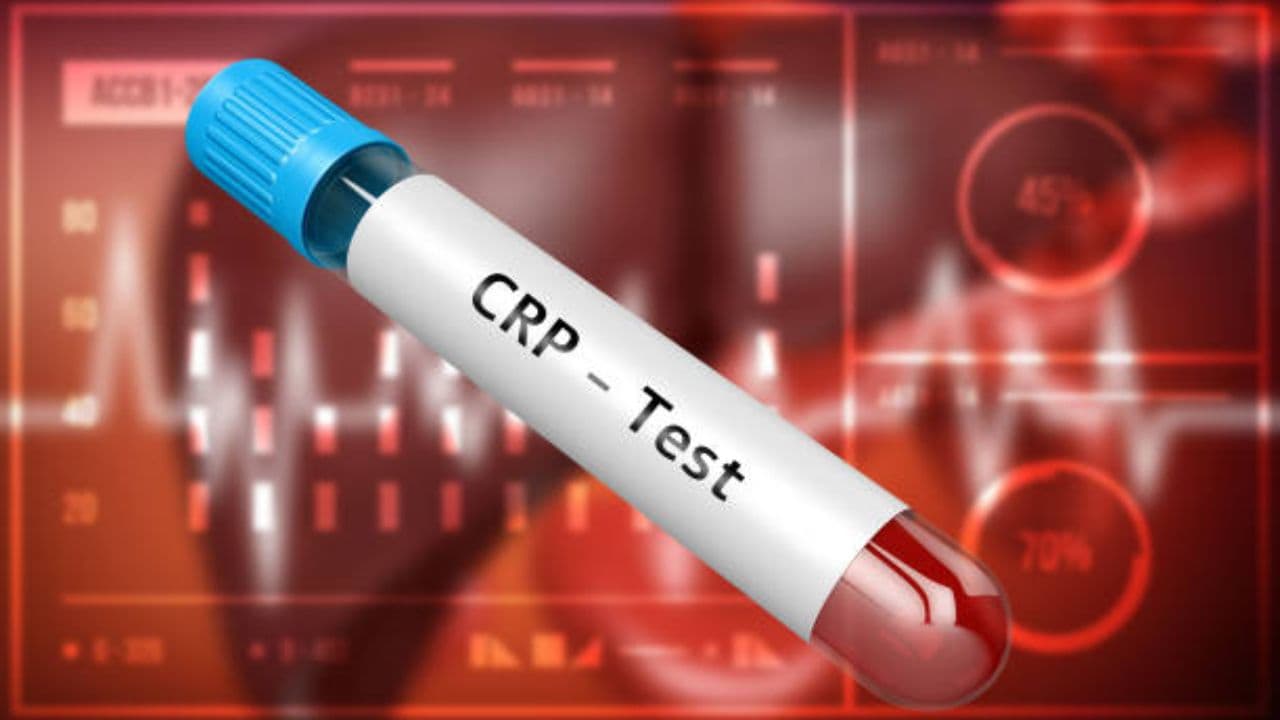 crp test for which disease 