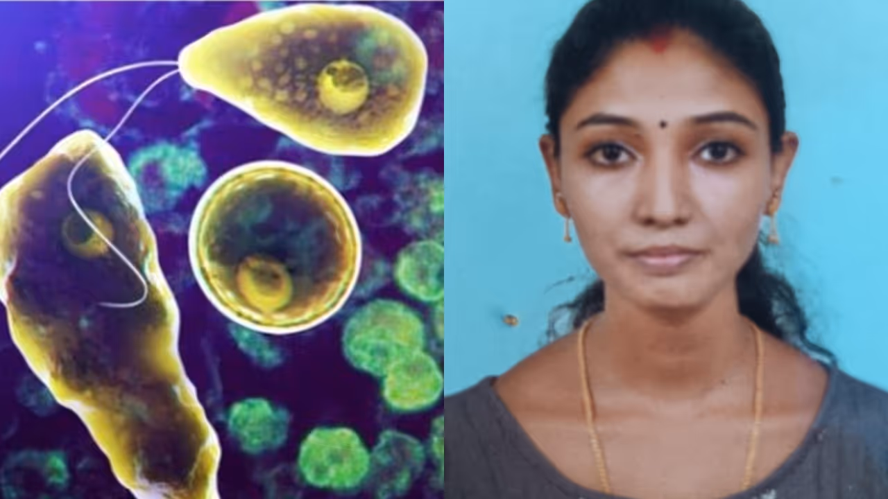 amoebic encephalitis