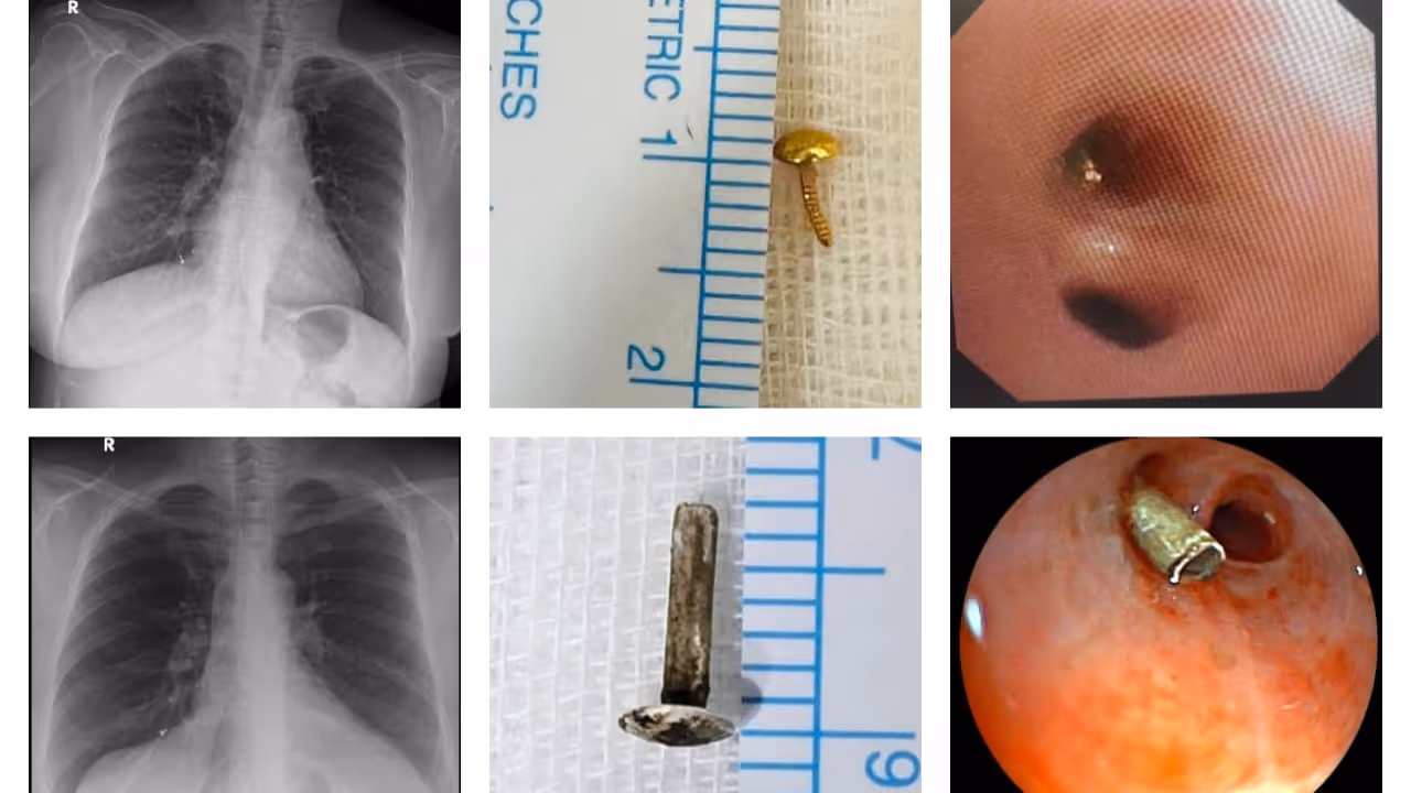 nose pin part from lungs nose pin part from lungs