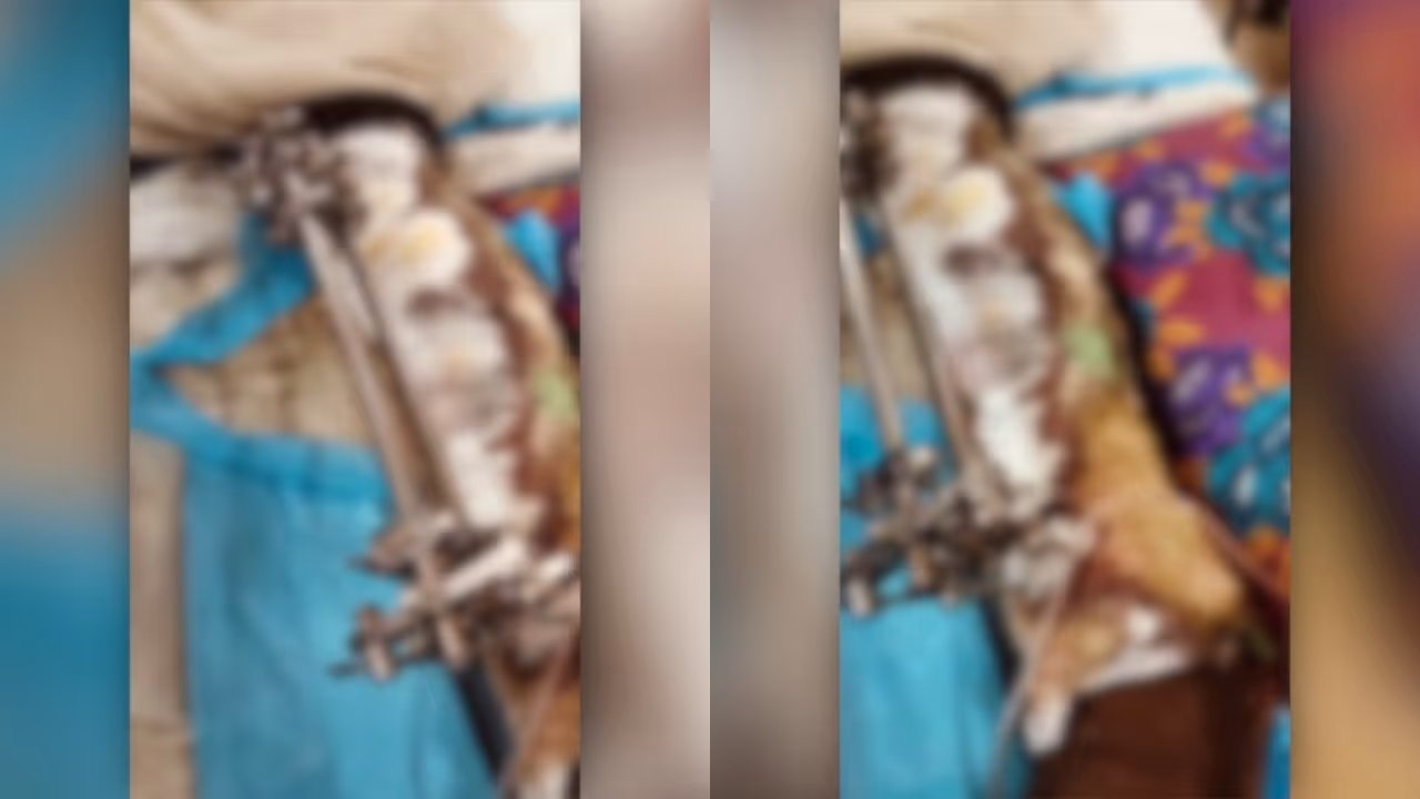 Severe treatment failure at medical college Severe treatment failure at medical college