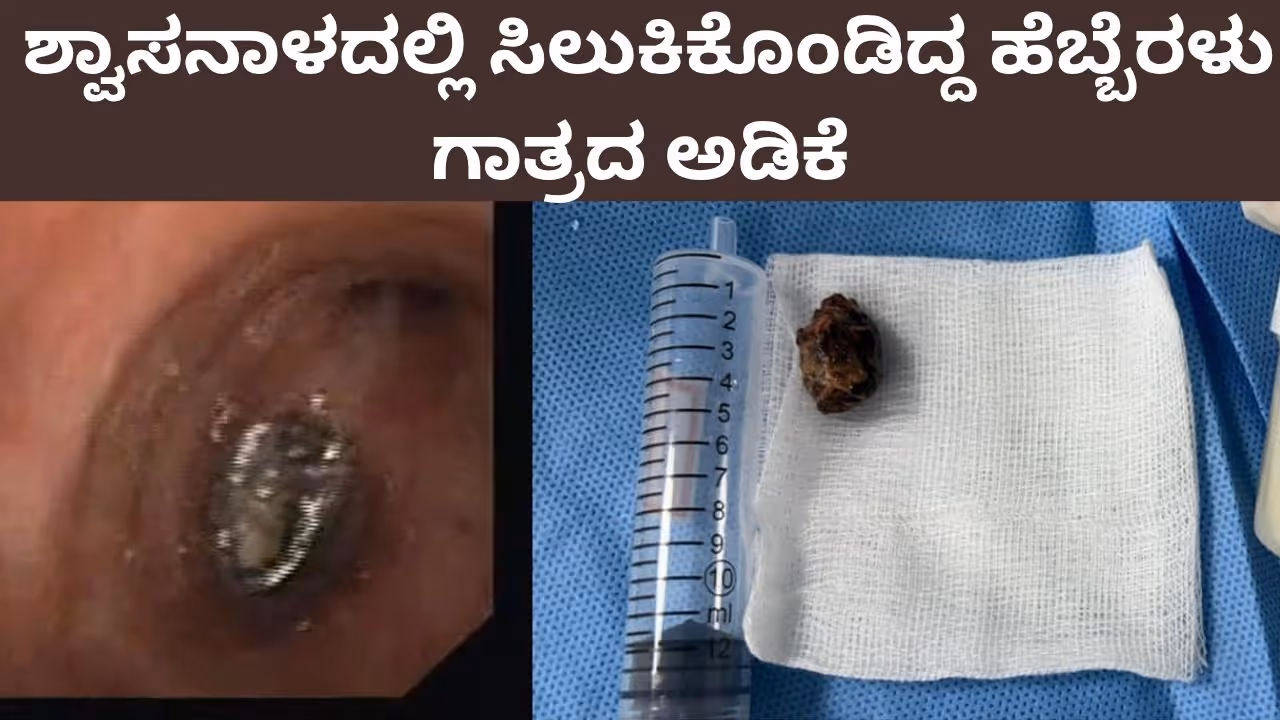 Mandya Mandya