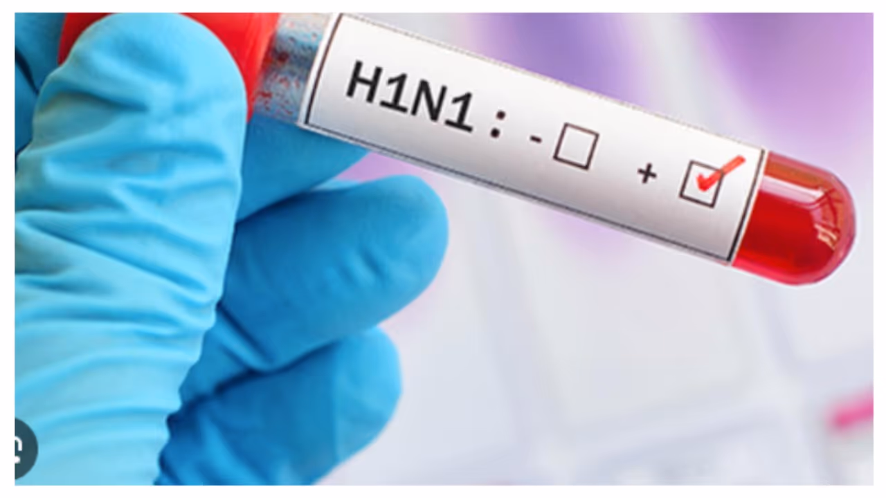 h1n1 h1n1