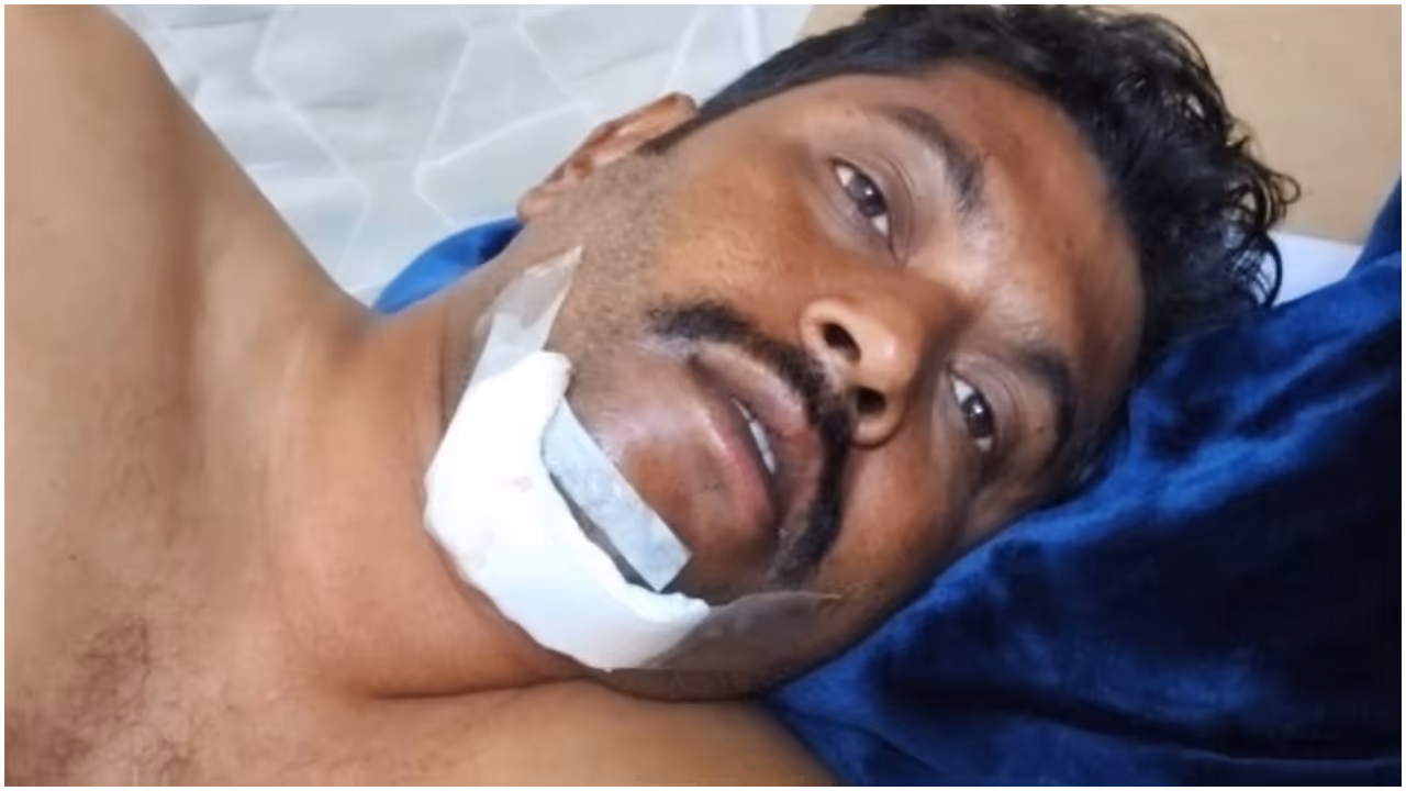 malayali driver injured malayali driver injured