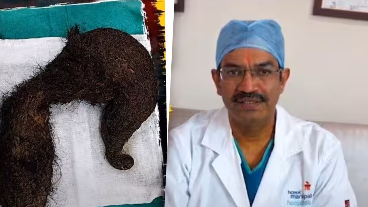 Hairball in stomach Hairball in stomach