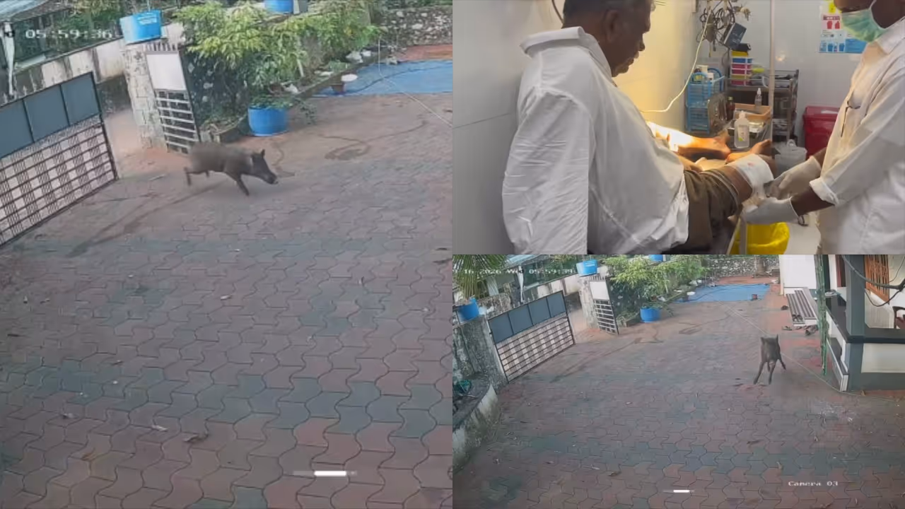 wild boar attack wild boar attack