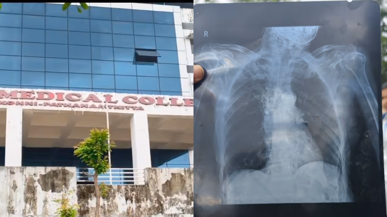 konni medical college treatment error 16 year old gets wrong xray konni medical college treatment error 16 year old gets wrong xray