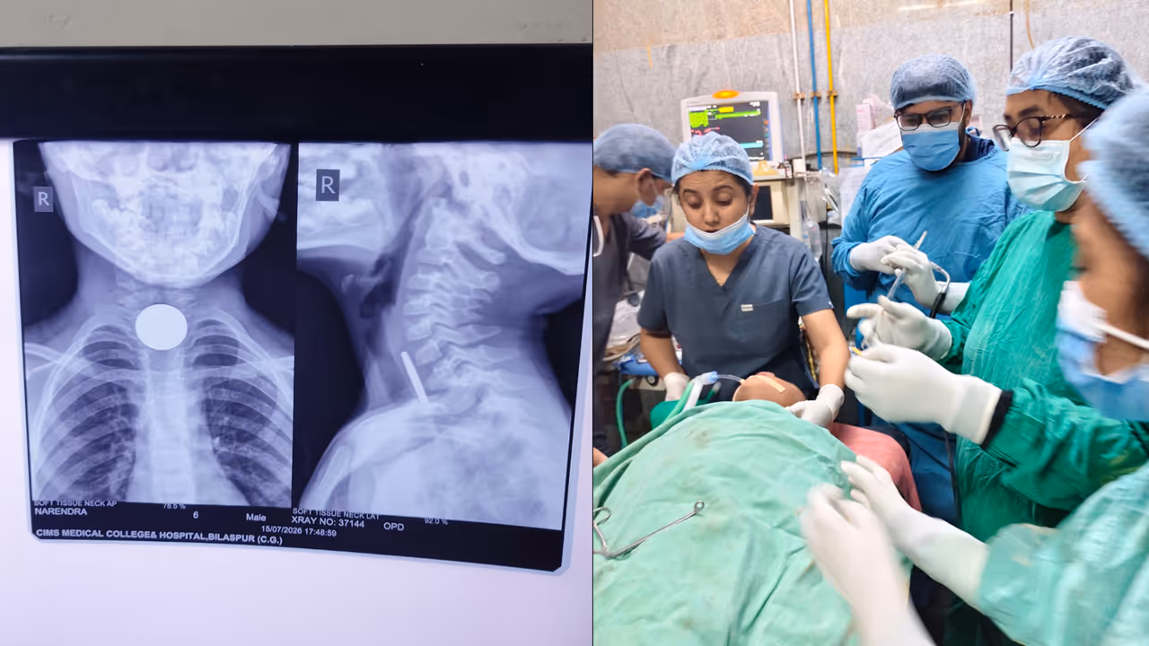 sims bilaspur successful emergency surgery sims bilaspur successful emergency surgery
