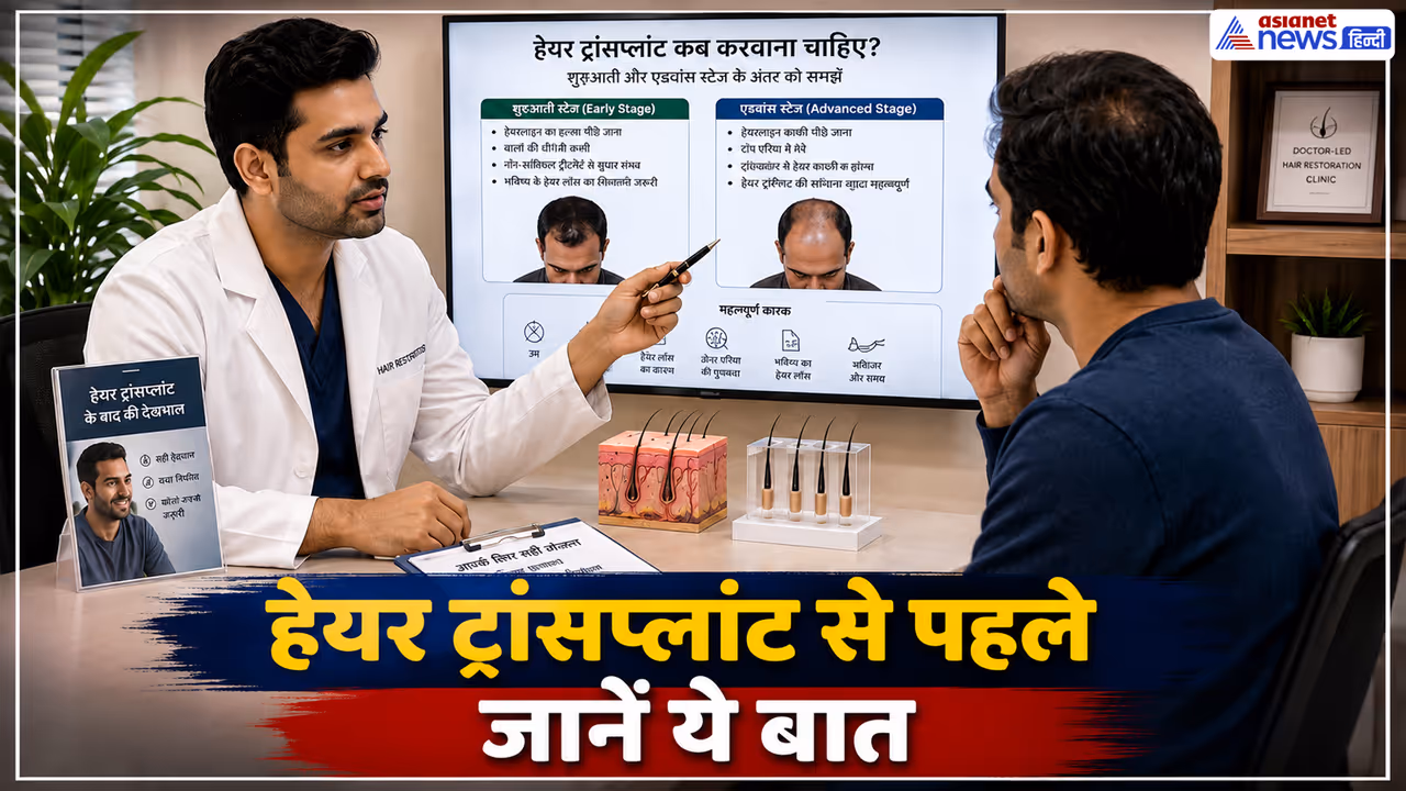 hair transplant right age hair transplant right age