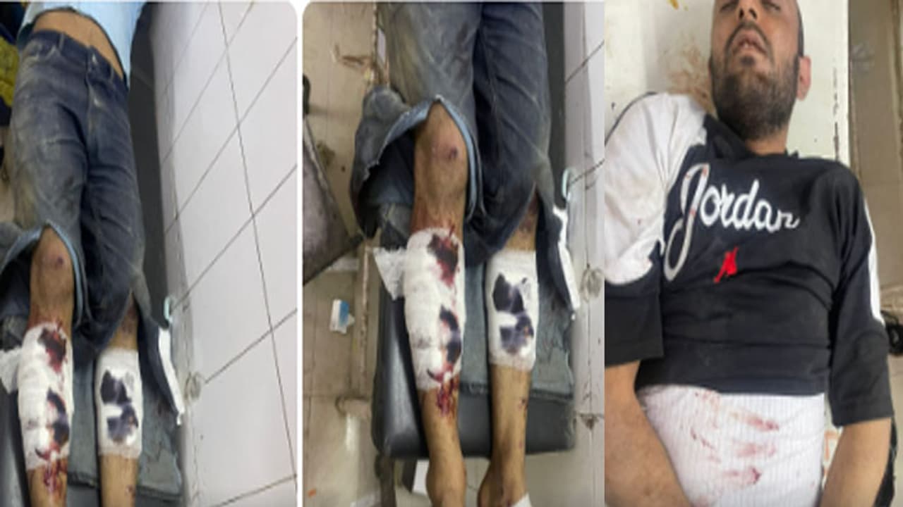 Rajasthan Police shot 4 miscreants within 24 hours in sikar news Rajasthan Police shot 4 miscreants within 24 hours in sikar news