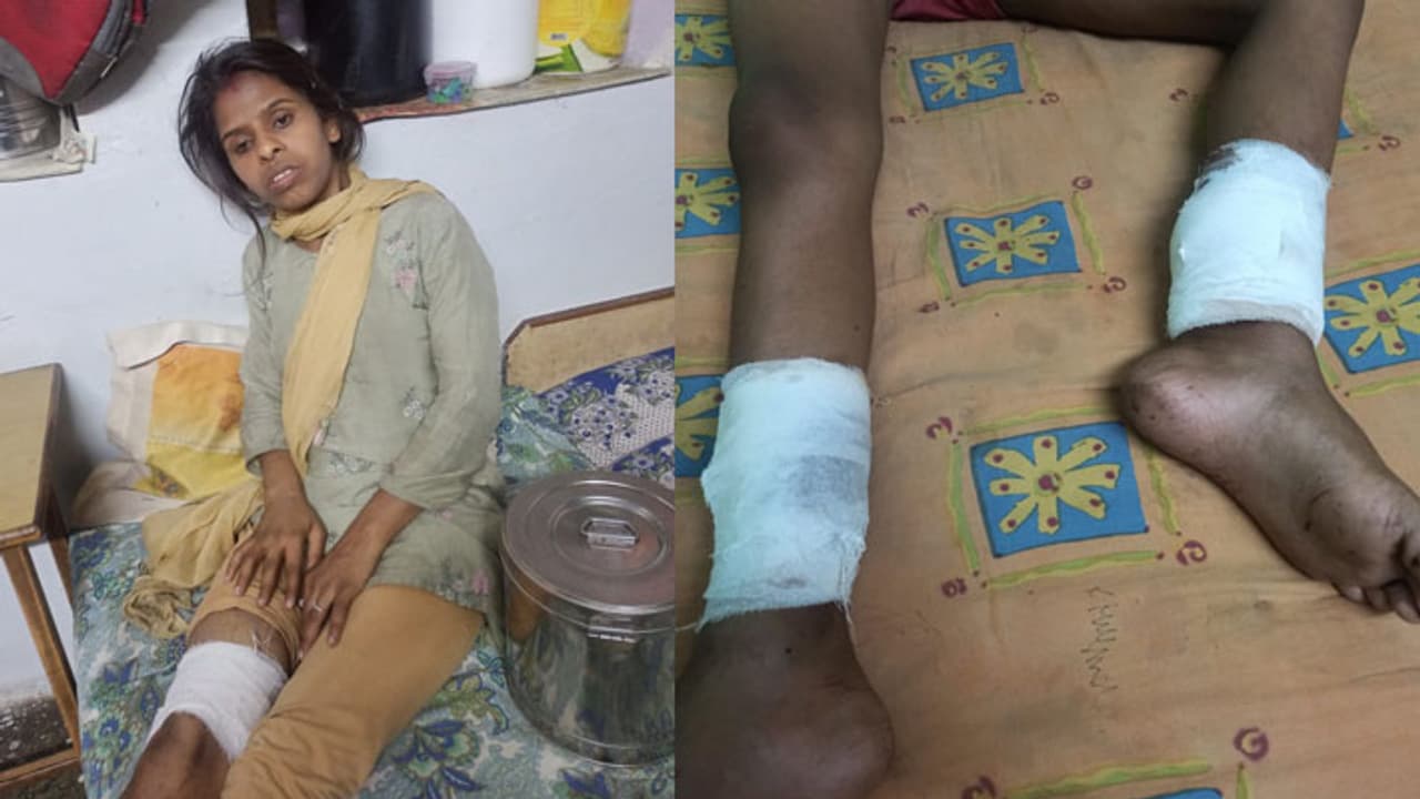 Jaipur painful accident Jaipur painful accident