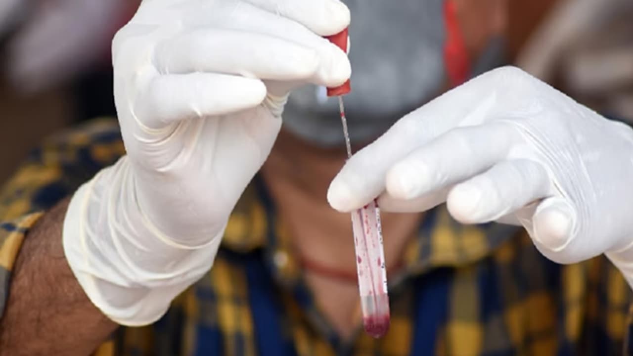 gujarat chandipura virus gujarat chandipura virus