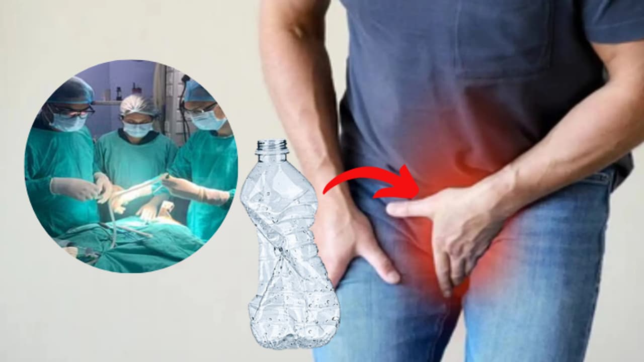 Prayagraj Engineering Student Got Bottle Stuck In Private Part Doctors Took It Out Prayagraj Engineering Student Got Bottle Stuck In Private Part Doctors Took It Out