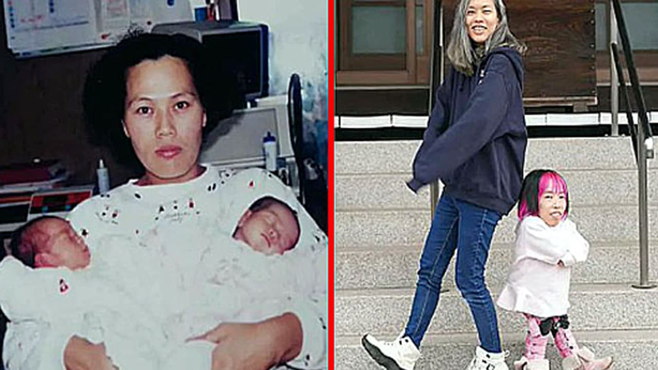 unusual twins with weird height difference2 unusual twins with weird height difference2