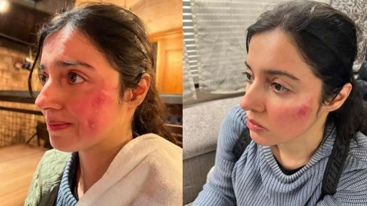 divya khosla kumar injured while shooting for her upcoming project share photos got trolled KPJ divya khosla kumar injured while shooting for her upcoming project share photos got trolled KPJ