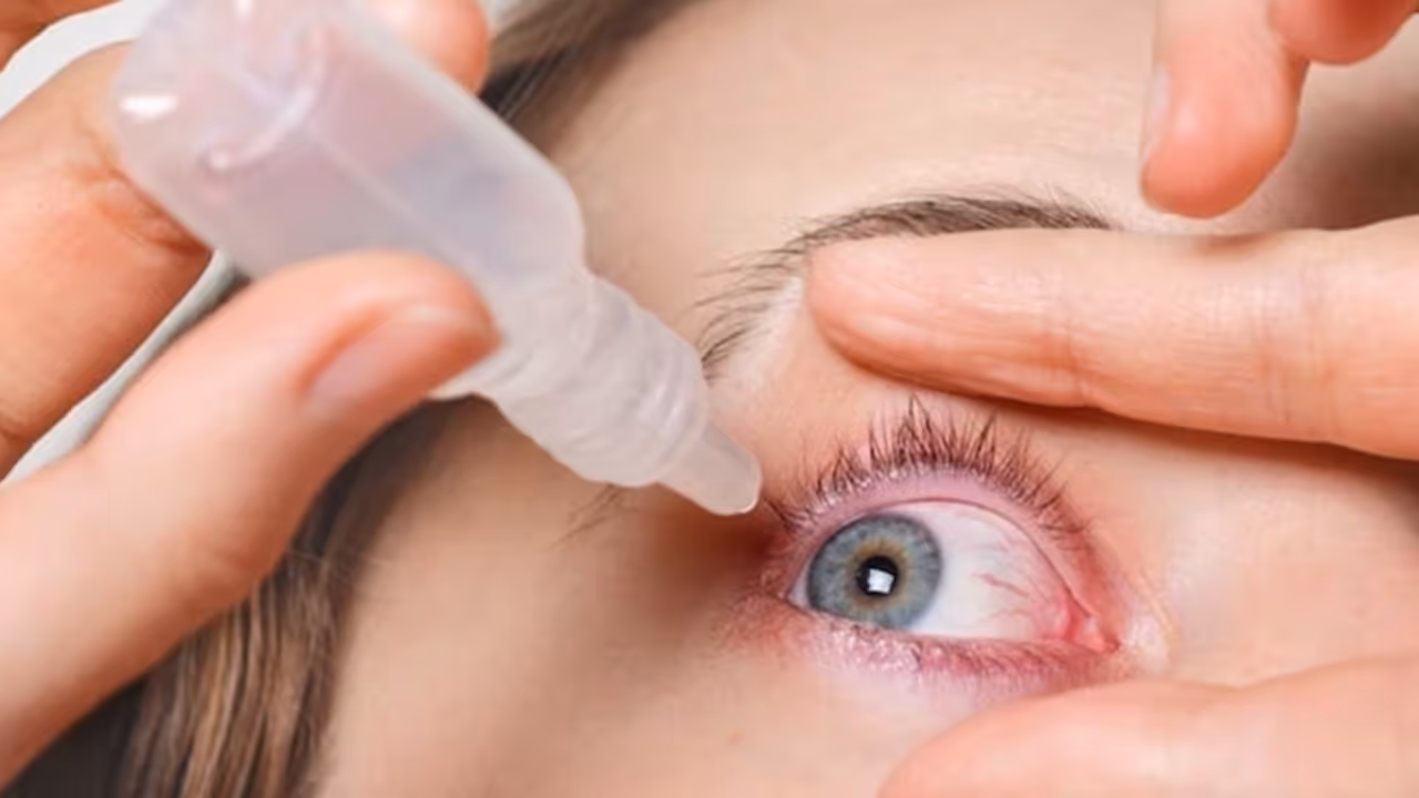 Eye Flu 5 Types and Treatment