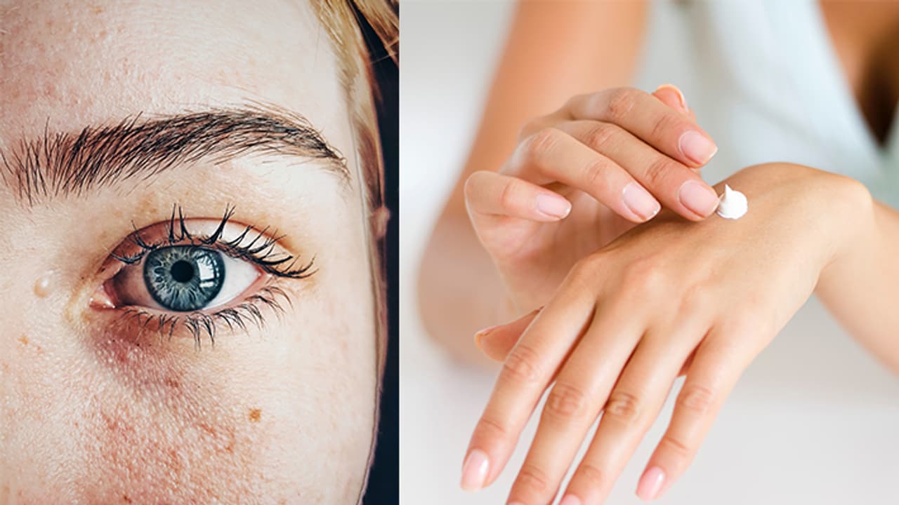 tips to protect skin from ac