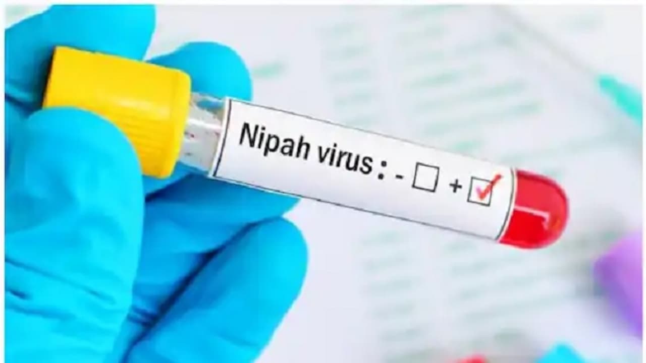 Nipah virus