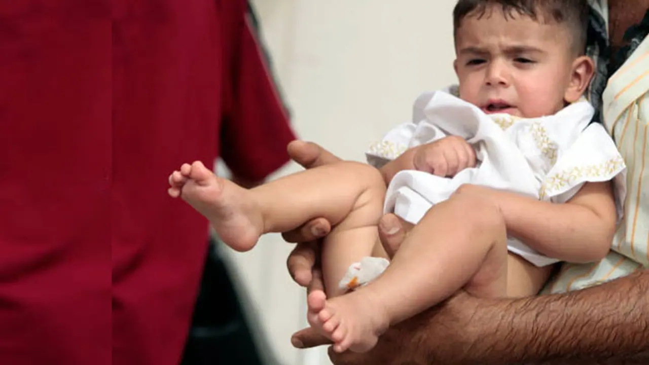 circumcision circumcision