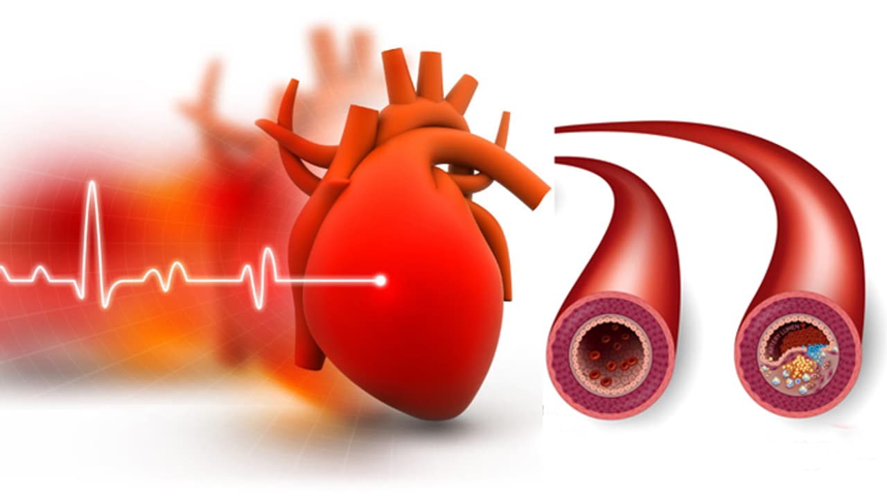 Heart Blockage Ayurvedic Therapy Heart Blockage Ayurvedic Therapy