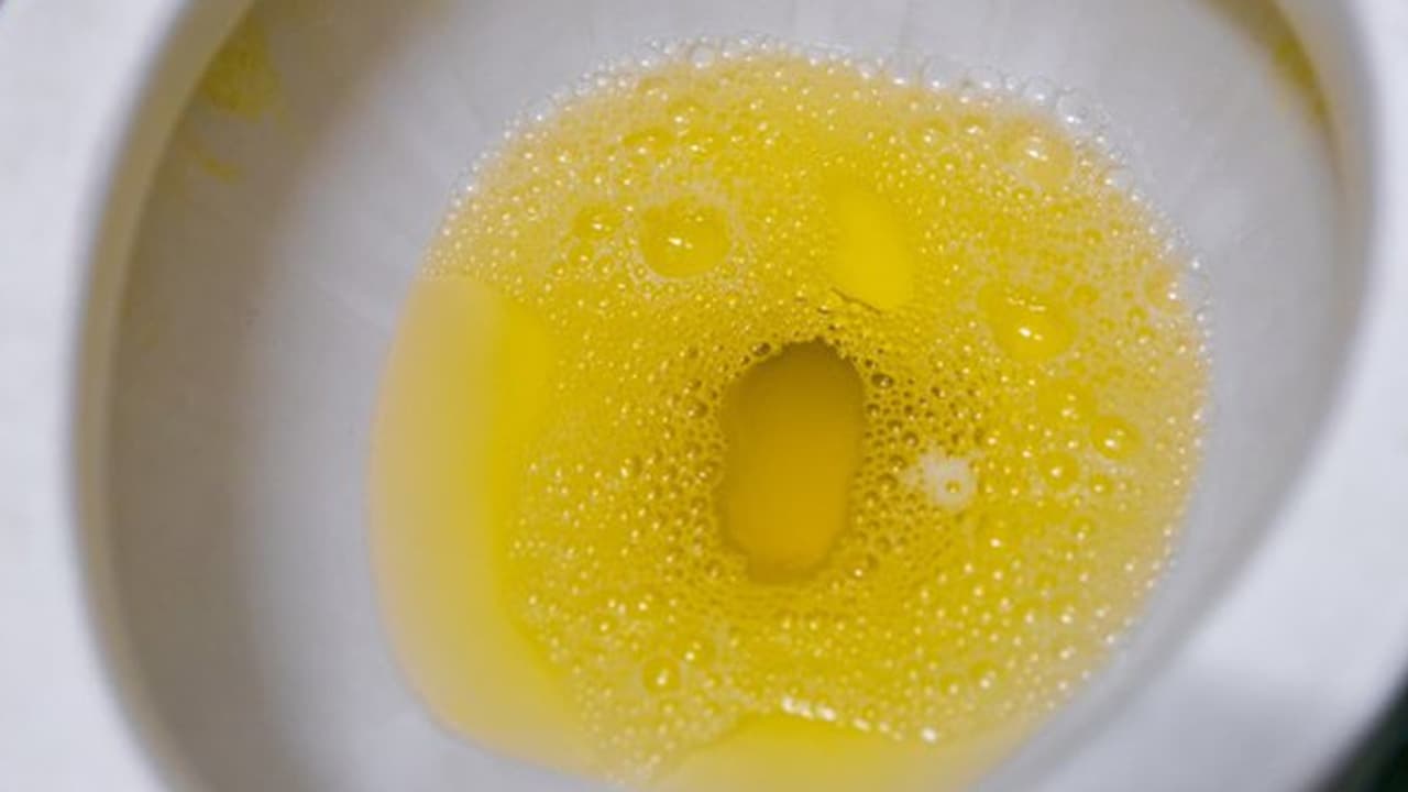 why urine foam bubbles why urine foam bubbles