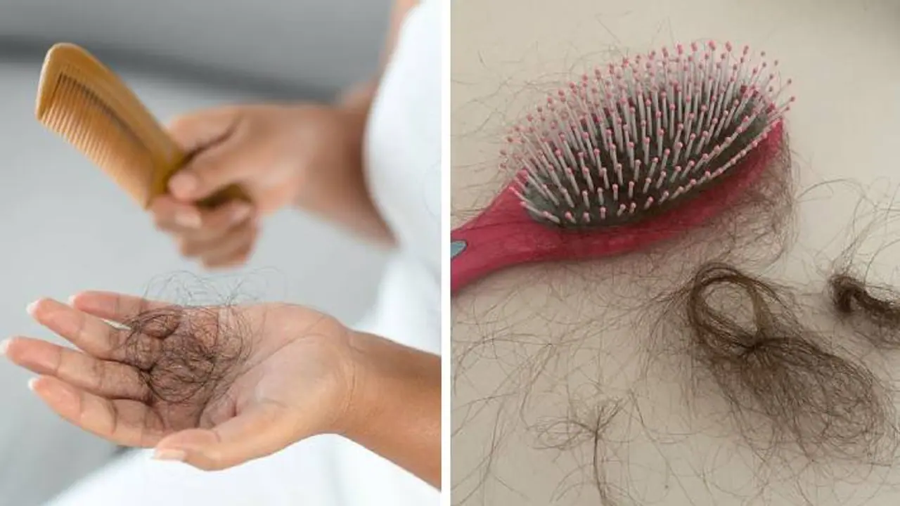 Hair fall reduced by fulfilling the deficiency of 5 vitamins Hair fall reduced by fulfilling the deficiency of 5 vitamins